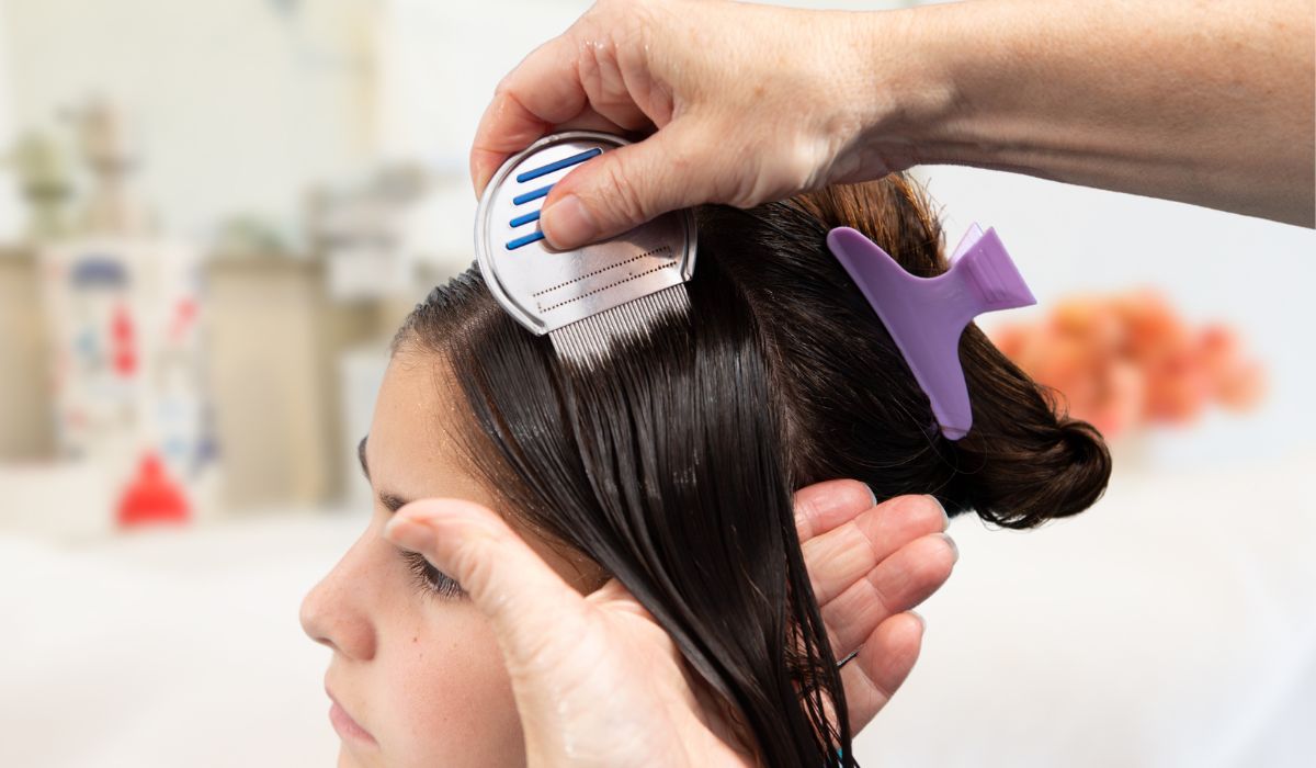 How Long Does It Take To Get Rid of Lice?